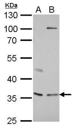 Invitrogen Decorin Polyclonal Antibody 100 &mu;L | Buy Online | Invitrogen&trade; | Fisher Scientific