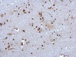 Invitrogen HMGB1 Polyclonal Antibody 100 &mu;L | Buy Online | Invitrogen&trade; | Fisher Scientific