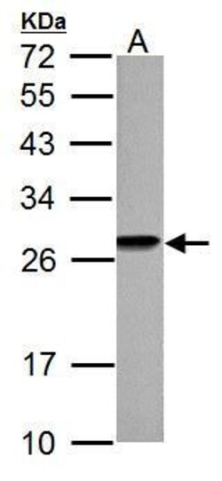 Invitrogen HMGB1 Polyclonal Antibody 100 &mu;L | Buy Online | Invitrogen&trade; | Fisher Scientific
