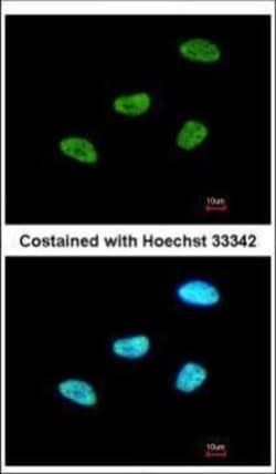 Invitrogen MEF2A Polyclonal Antibody 100 &mu;L | Buy Online | Invitrogen&trade; | Fisher Scientific