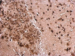 Invitrogen MEF2A Polyclonal Antibody 100 &mu;L | Buy Online | Invitrogen&trade; | Fisher Scientific