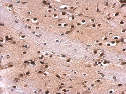 Invitrogen MEF2A Polyclonal Antibody 100 &mu;L | Buy Online | Invitrogen&trade; | Fisher Scientific