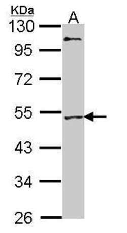 Invitrogen MEF2A Polyclonal Antibody 100 &mu;L | Buy Online | Invitrogen&trade; | Fisher Scientific
