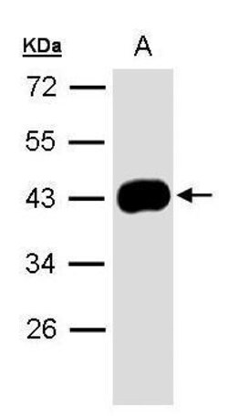Invitrogen Maspin Polyclonal Antibody 100 &mu;L; Unconjugated:Antibodies,