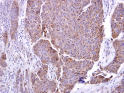 Invitrogen&trade;&nbsp;ADAM17 Polyclonal Antibody