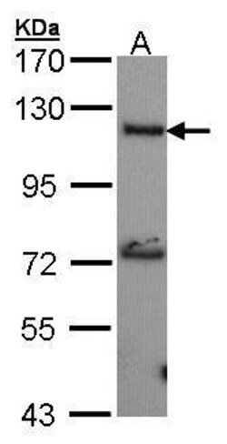 Invitrogen ADCY2 Polyclonal Antibody 100 &mu;L; Unconjugated:Antibodies,