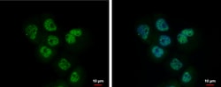 Invitrogen™ Adenosine Kinase Polyclonal Antibody