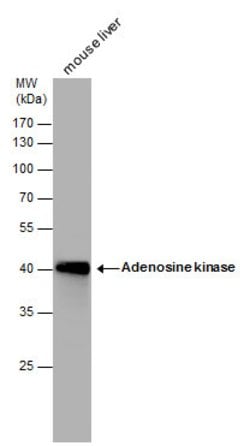 Adenosine Kinase Polyclonal Antibody, Invitrogen 100 &mu;L; Unconjugated:Antibodies,