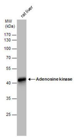 Adenosine Kinase Polyclonal Antibody, Invitrogen 100 &mu;L; Unconjugated:Antibodies,