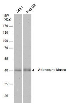 Adenosine Kinase Polyclonal Antibody, Invitrogen 100 &mu;L; Unconjugated:Antibodies,