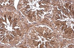 Invitrogen PGK1 Polyclonal Antibody 100 μL; Unconjugated:Antibodies,