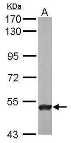 Invitrogen ABAT Polyclonal Antibody 100 &mu;L; Unconjugated:Antibodies,
