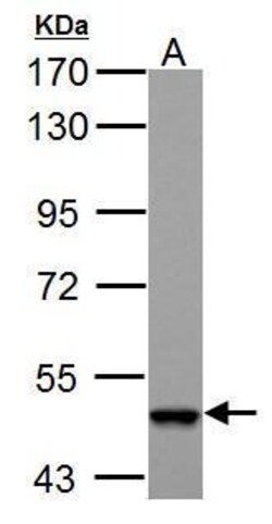 Invitrogen ABAT Polyclonal Antibody 100 &mu;L; Unconjugated:Antibodies,