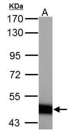 Invitrogen ABAT Polyclonal Antibody 100 &mu;L; Unconjugated:Antibodies,