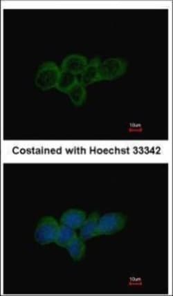 Invitrogen LDHA Polyclonal Antibody 100 &mu;L | Buy Online | Invitrogen&trade; | Fisher Scientific