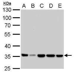 Invitrogen LDHA Polyclonal Antibody 100 &mu;L | Buy Online | Invitrogen&trade; | Fisher Scientific