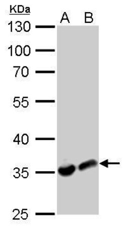 Invitrogen LDHA Polyclonal Antibody 100 &mu;L | Buy Online | Invitrogen&trade; | Fisher Scientific