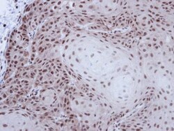 Invitrogen NONO Polyclonal Antibody 100 &mu;L | Buy Online | Invitrogen&trade; | Fisher Scientific