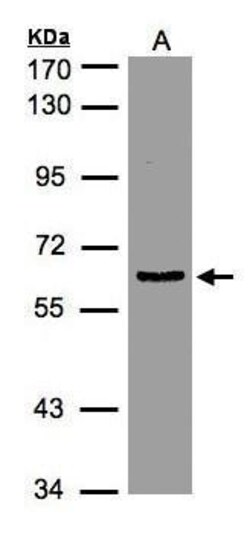 Invitrogen eIF3d Polyclonal Antibody 100 &mu;L; Unconjugated:Antibodies,