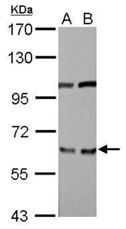 Invitrogen eIF3d Polyclonal Antibody 100 &mu;L; Unconjugated:Antibodies,