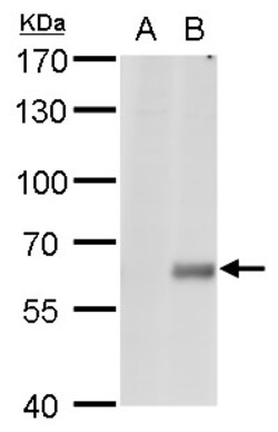 Invitrogen CPNE1 Polyclonal Antibody 100 &mu;L; Unconjugated:Antibodies,