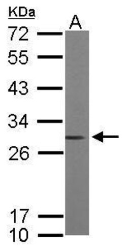 Invitrogen RhoGDI Polyclonal Antibody 100 &mu;L; Unconjugated:Antibodies,
