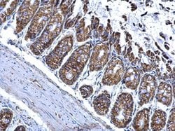 Invitrogen ALDH2 Polyclonal Antibody 100 &mu;L; Unconjugated:Antibodies,