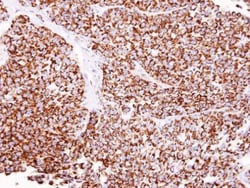 Invitrogen ALDH2 Polyclonal Antibody 100 &mu;L; Unconjugated:Antibodies,