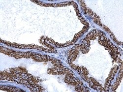 Invitrogen ALDH2 Polyclonal Antibody 100 &mu;L; Unconjugated:Antibodies,