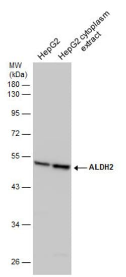 Invitrogen ALDH2 Polyclonal Antibody 100 &mu;L; Unconjugated:Antibodies,