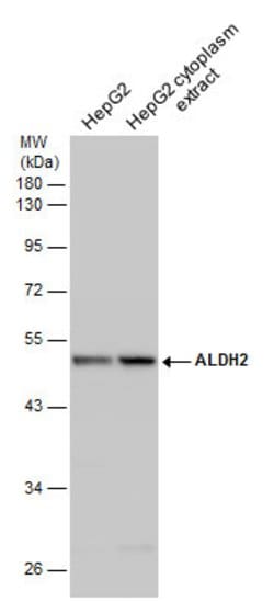 Invitrogen ALDH2 Polyclonal Antibody 100 &mu;L; Unconjugated:Antibodies,