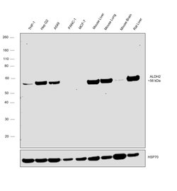 Invitrogen ALDH2 Polyclonal Antibody 100 &mu;L; Unconjugated:Antibodies,