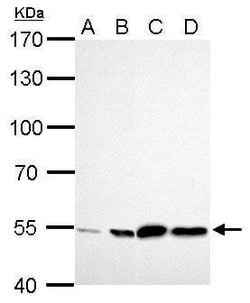 Invitrogen ALDH2 Polyclonal Antibody 100 &mu;L; Unconjugated:Antibodies,