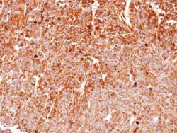 Invitrogen HSP90 beta Polyclonal Antibody 100 &mu;L | Buy Online | Invitrogen&trade; | Fisher Scientific
