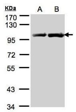 Invitrogen HSP90 beta Polyclonal Antibody 100 &mu;L | Buy Online | Invitrogen&trade; | Fisher Scientific