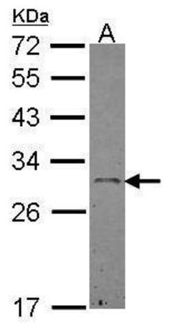 Invitrogen Ephrin A3 Polyclonal Antibody 100 &mu;L; Unconjugated:Antibodies,