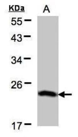 Invitrogen BTF3 Polyclonal Antibody 100 &mu;L; Unconjugated:Antibodies,
