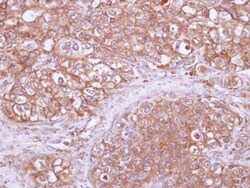 Invitrogen RhoGAP Polyclonal Antibody 100 &mu;L; Unconjugated:Antibodies,