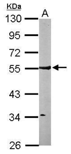Invitrogen RhoGAP Polyclonal Antibody 100 &mu;L; Unconjugated:Antibodies,