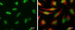 Invitrogen UAP56 Polyclonal Antibody 100 &mu;L; Unconjugated:Antibodies,