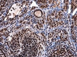 Invitrogen UAP56 Polyclonal Antibody 100 &mu;L; Unconjugated:Antibodies,
