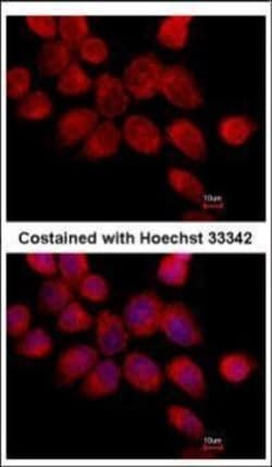 Invitrogen Transketolase Polyclonal Antibody 100 μL; Unconjugated:Antibodies,