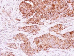 KNP-I Polyclonal Antibody:Antibodies, Polyclonal