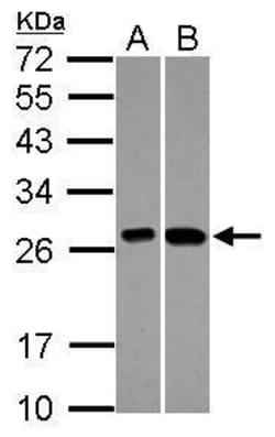 KNP-I Polyclonal Antibody:Antibodies, Polyclonal