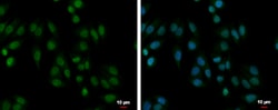 Invitrogen PABPN1 Polyclonal Antibody 100 &mu;L; Unconjugated:Antibodies,