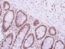 Invitrogen PABPN1 Polyclonal Antibody 100 &mu;L; Unconjugated:Antibodies,