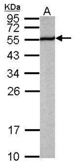 Invitrogen PABPN1 Polyclonal Antibody 100 &mu;L; Unconjugated:Antibodies,