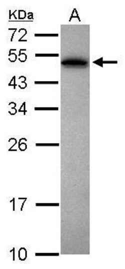Invitrogen PABPN1 Polyclonal Antibody 100 &mu;L; Unconjugated:Antibodies,