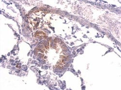 YARS Polyclonal Antibody:Antibodies, Polyclonal