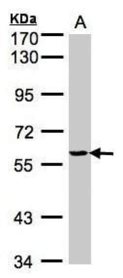 YARS Polyclonal Antibody:Antibodies, Polyclonal
